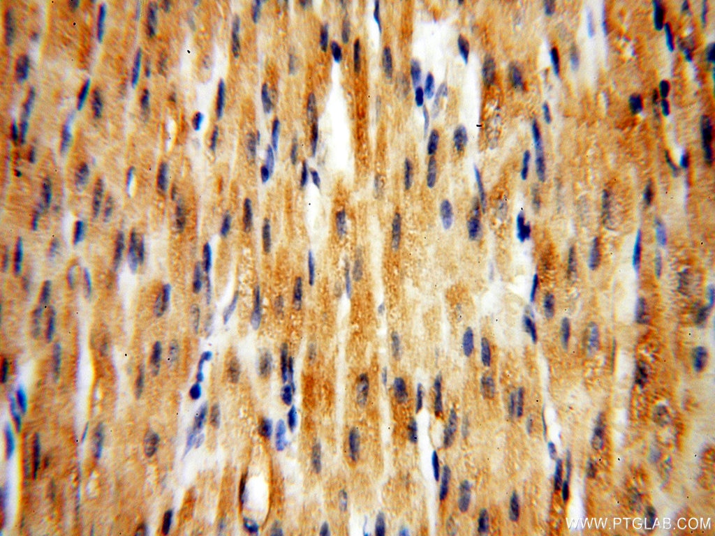 IHC staining of human heart using 13901-1-AP