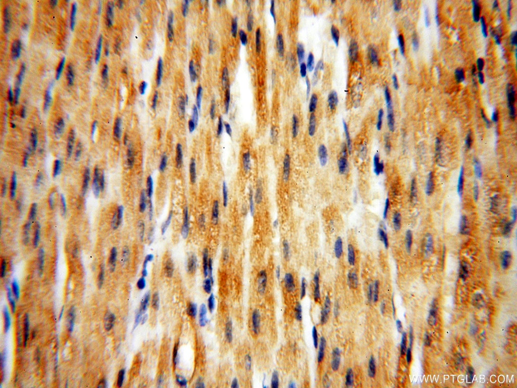 Immunohistochemistry (IHC) staining of human heart tissue using HPS5 Polyclonal antibody (13901-1-AP)