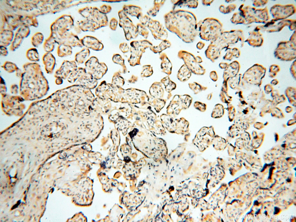 Immunohistochemistry (IHC) staining of human placenta tissue using HPS5 Polyclonal antibody (13901-1-AP)