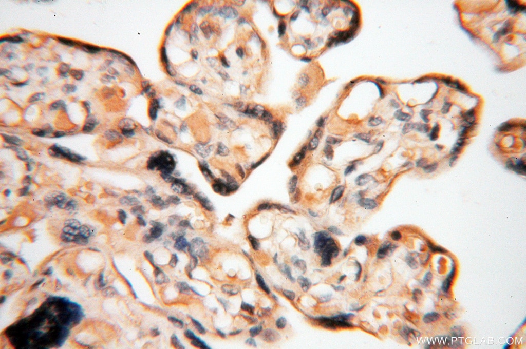 Immunohistochemistry (IHC) staining of human placenta tissue using HPS5 Polyclonal antibody (13901-1-AP)