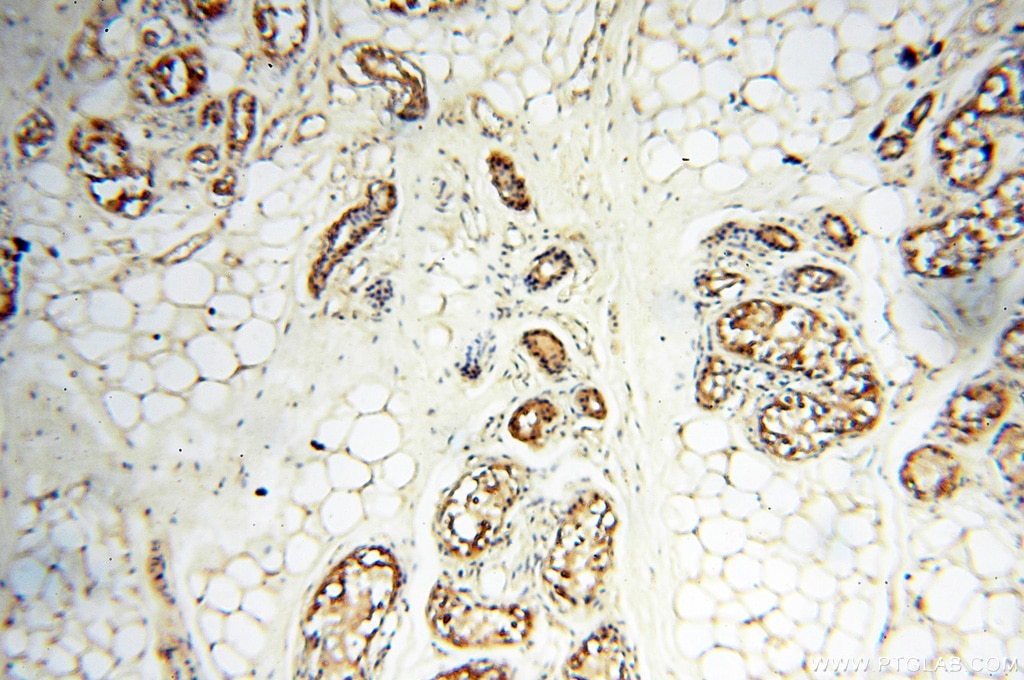 Immunohistochemistry (IHC) staining of human skin tissue using HPS5 Polyclonal antibody (13901-1-AP)