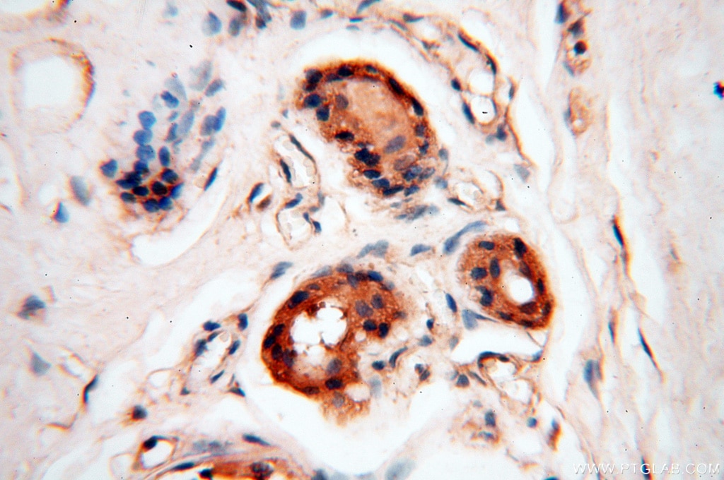 Immunohistochemistry (IHC) staining of human skin tissue using HPS5 Polyclonal antibody (13901-1-AP)