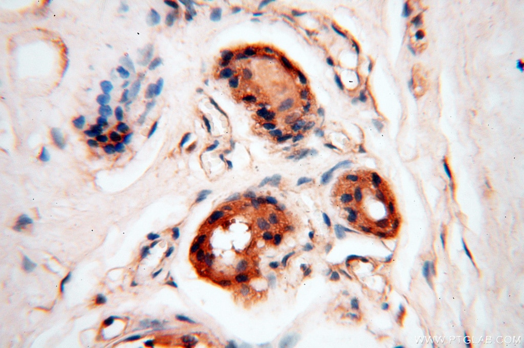 IHC staining of human skin using 13901-1-AP