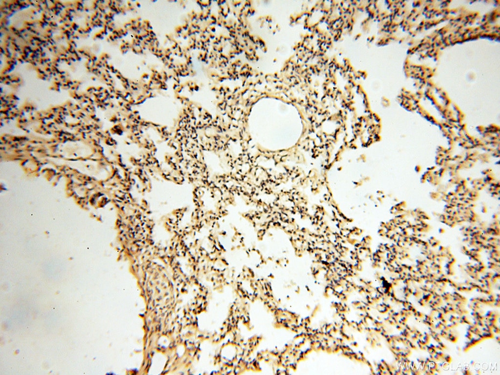 Immunohistochemistry (IHC) staining of human lung tissue using HPS5 Polyclonal antibody (13901-1-AP)