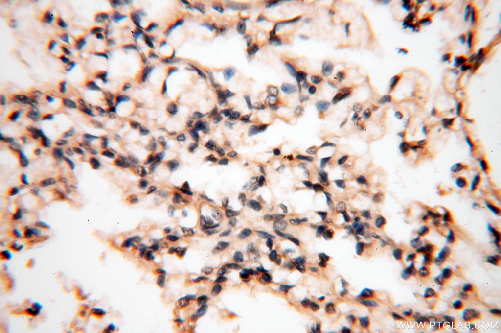 IHC staining of human lung using 13901-1-AP
