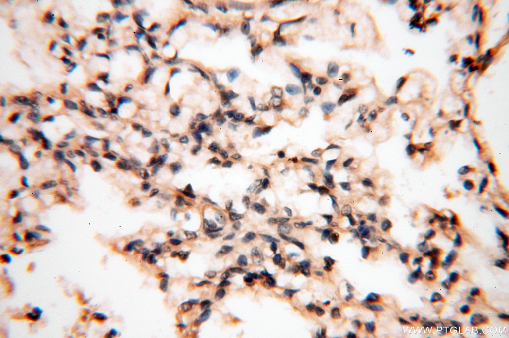 Immunohistochemistry (IHC) staining of human lung tissue using HPS5 Polyclonal antibody (13901-1-AP)