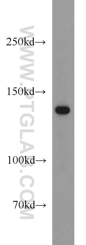 WB analysis of mouse liver using 13901-1-AP