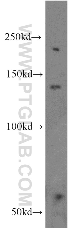 Western Blot (WB) analysis of mouse spleen tissue using HPS5 Polyclonal antibody (13901-1-AP)