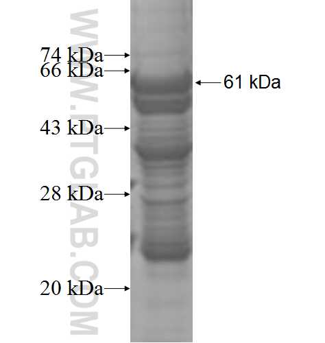 HPS5 fusion protein Ag4691 SDS-PAGE