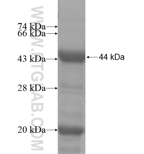 HPS5 fusion protein Ag4867 SDS-PAGE
