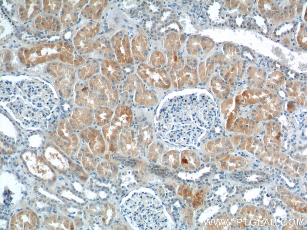 Immunohistochemistry (IHC) staining of human kidney tissue using HPS6 Polyclonal antibody (11371-1-AP)