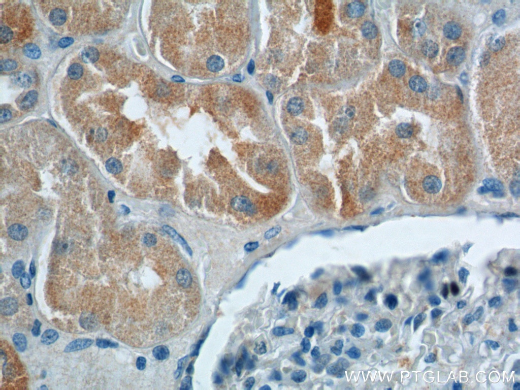 Immunohistochemistry (IHC) staining of human kidney tissue using HPS6 Polyclonal antibody (11371-1-AP)