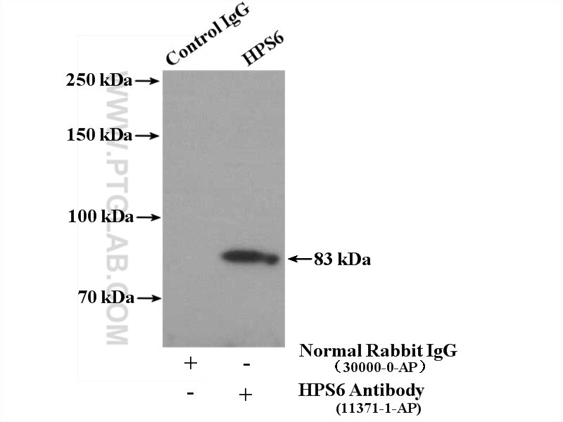 Immunoprecipitation (IP) experiment of HeLa cells using HPS6 Polyclonal antibody (11371-1-AP)