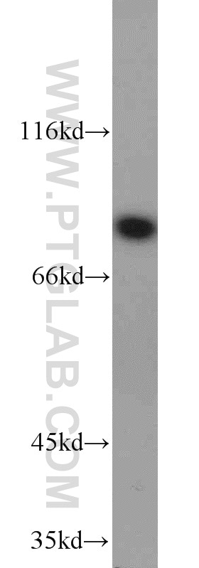 Western Blot (WB) analysis of HeLa cells using HPS6 Polyclonal antibody (11371-1-AP)