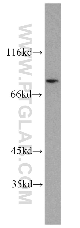 Western Blot (WB) analysis of MCF-7 cells using HPS6 Polyclonal antibody (11371-1-AP)