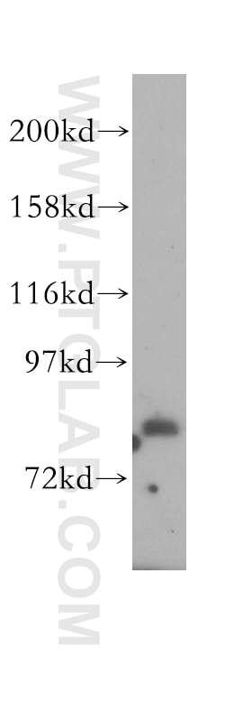 Western Blot (WB) analysis of HEK-293 cells using HPS6 Polyclonal antibody (11371-1-AP)