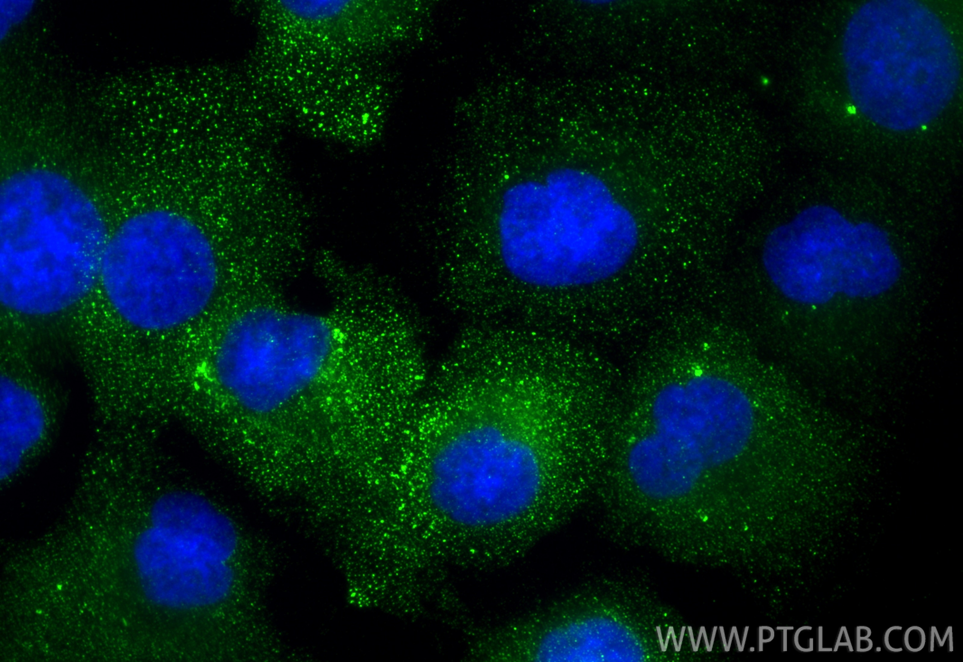 Immunofluorescence (IF) / fluorescent staining of DU 145 cells using HPSE Polyclonal antibody (16673-1-AP)