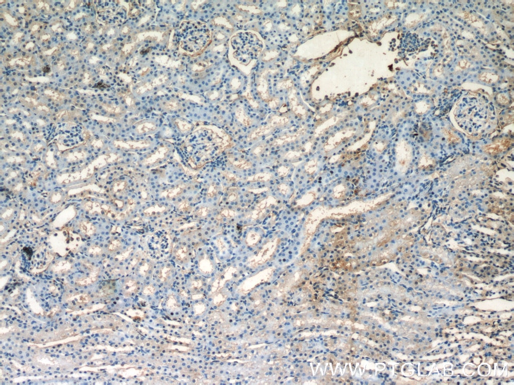 Immunohistochemistry (IHC) staining of mouse kidney tissue using HPSE Polyclonal antibody (16673-1-AP)