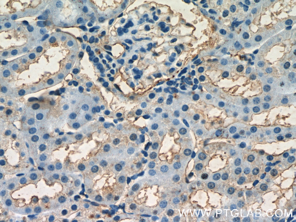 Immunohistochemistry (IHC) staining of mouse kidney tissue using HPSE Polyclonal antibody (16673-1-AP)