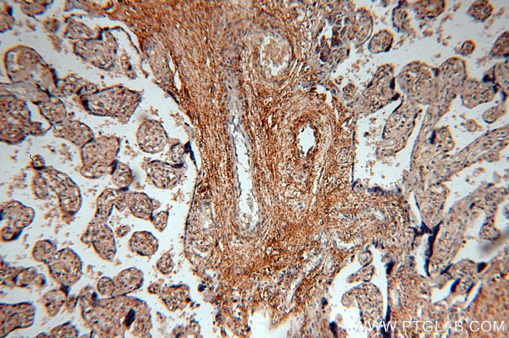 Immunohistochemistry (IHC) staining of human placenta tissue using HPSE Polyclonal antibody (16673-1-AP)