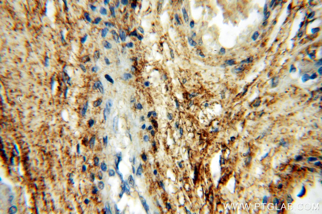 Immunohistochemistry (IHC) staining of human placenta tissue using HPSE Polyclonal antibody (16673-1-AP)