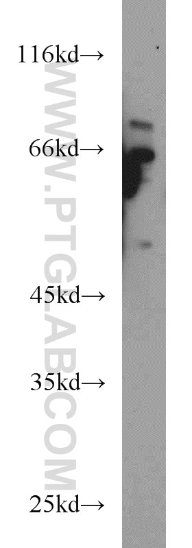 Western Blot (WB) analysis of DU 145 cells using HPSE Polyclonal antibody (16673-1-AP)
