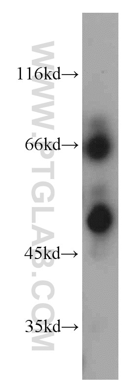 Western Blot (WB) analysis of DU 145 cells using HPSE Polyclonal antibody (16673-1-AP)