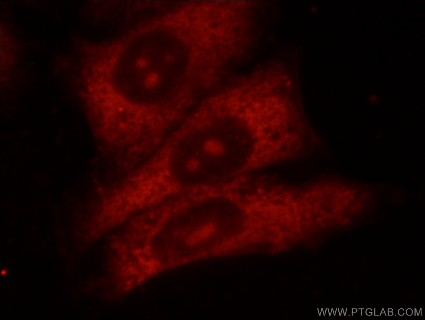 Immunofluorescence (IF) / fluorescent staining of HeLa cells using HPSE Polyclonal antibody (24529-1-AP)