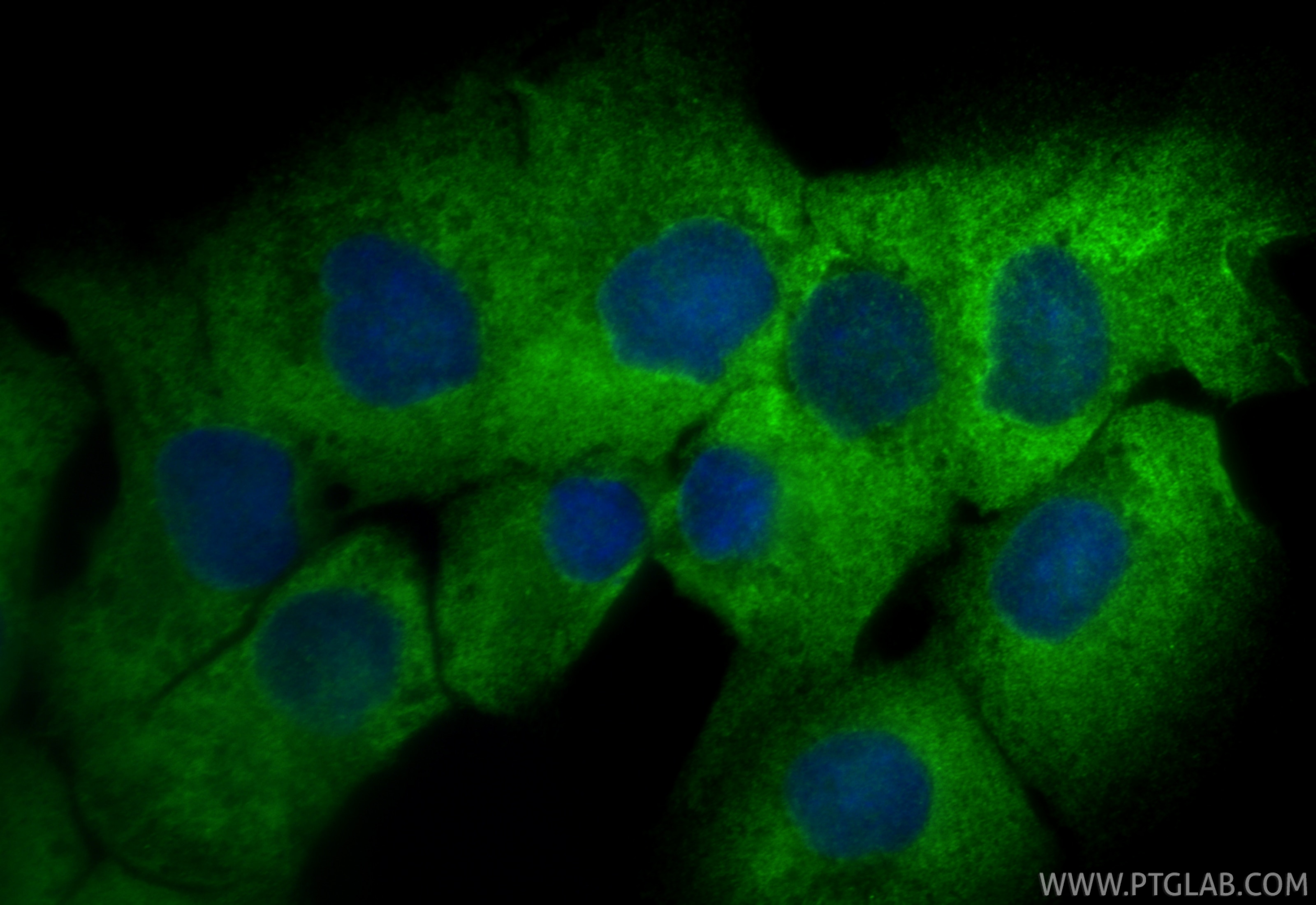 Immunofluorescence (IF) / fluorescent staining of DU 145 cells using HPSE Polyclonal antibody (24529-1-AP)