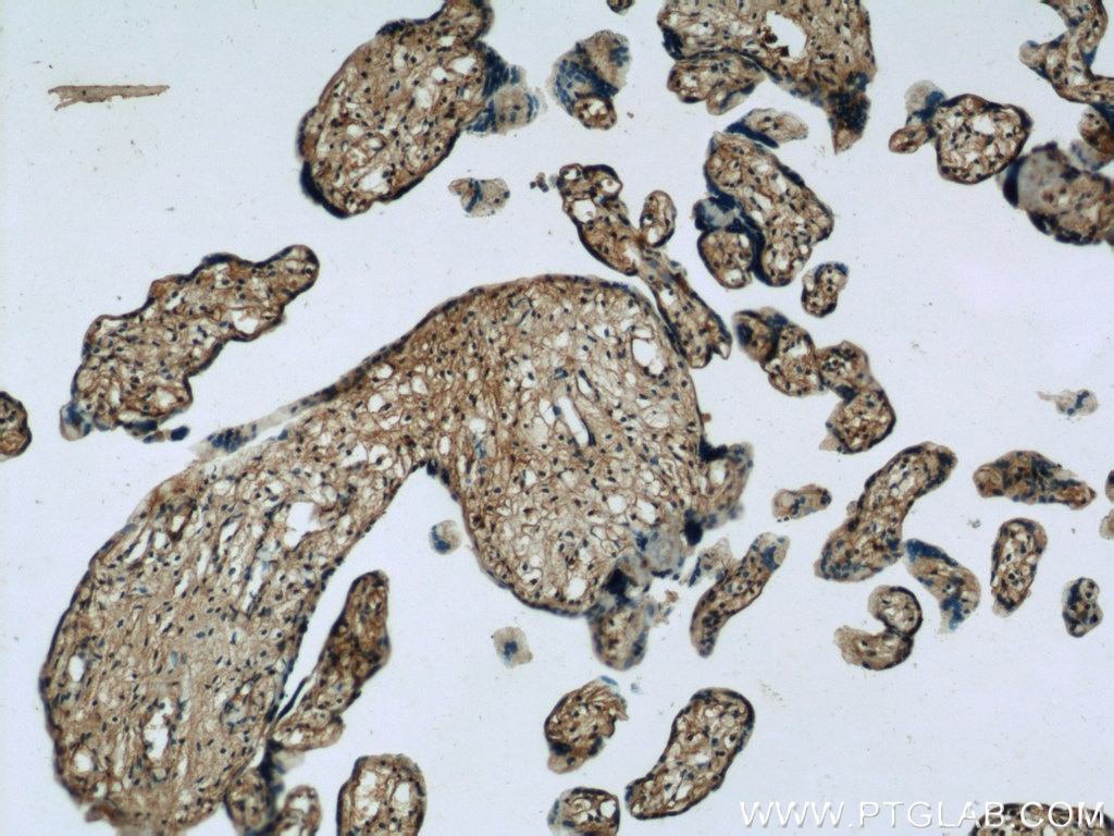 IHC staining of human placenta using 24529-1-AP