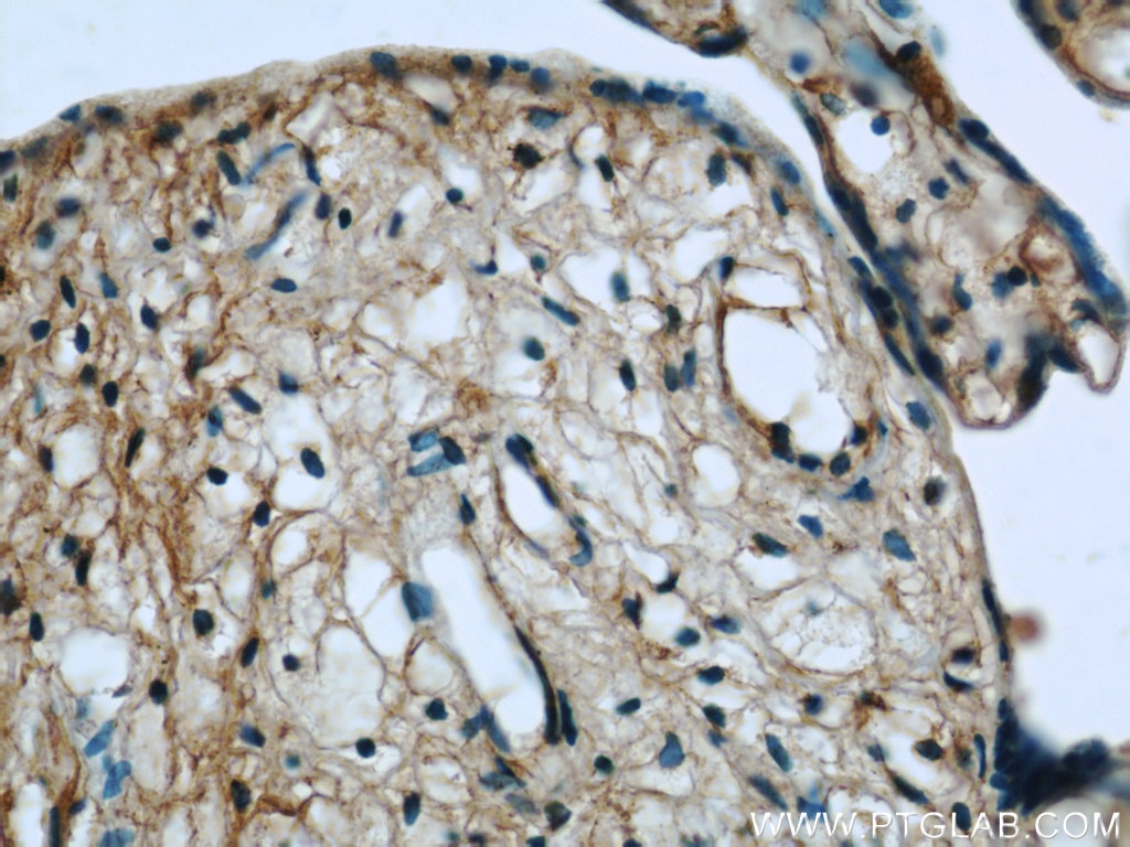 Immunohistochemistry (IHC) staining of human placenta tissue using HPSE Polyclonal antibody (24529-1-AP)