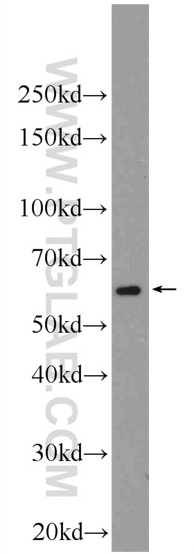 Western Blot (WB) analysis of Jurkat cells using HPSE Polyclonal antibody (24529-1-AP)