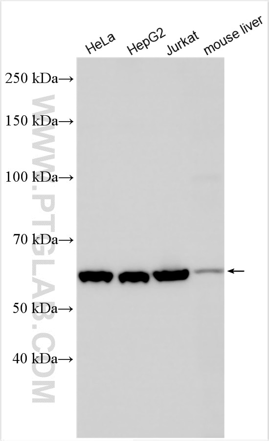 Western Blot (WB) analysis of various lysates using HPSE Polyclonal antibody (24529-1-AP)