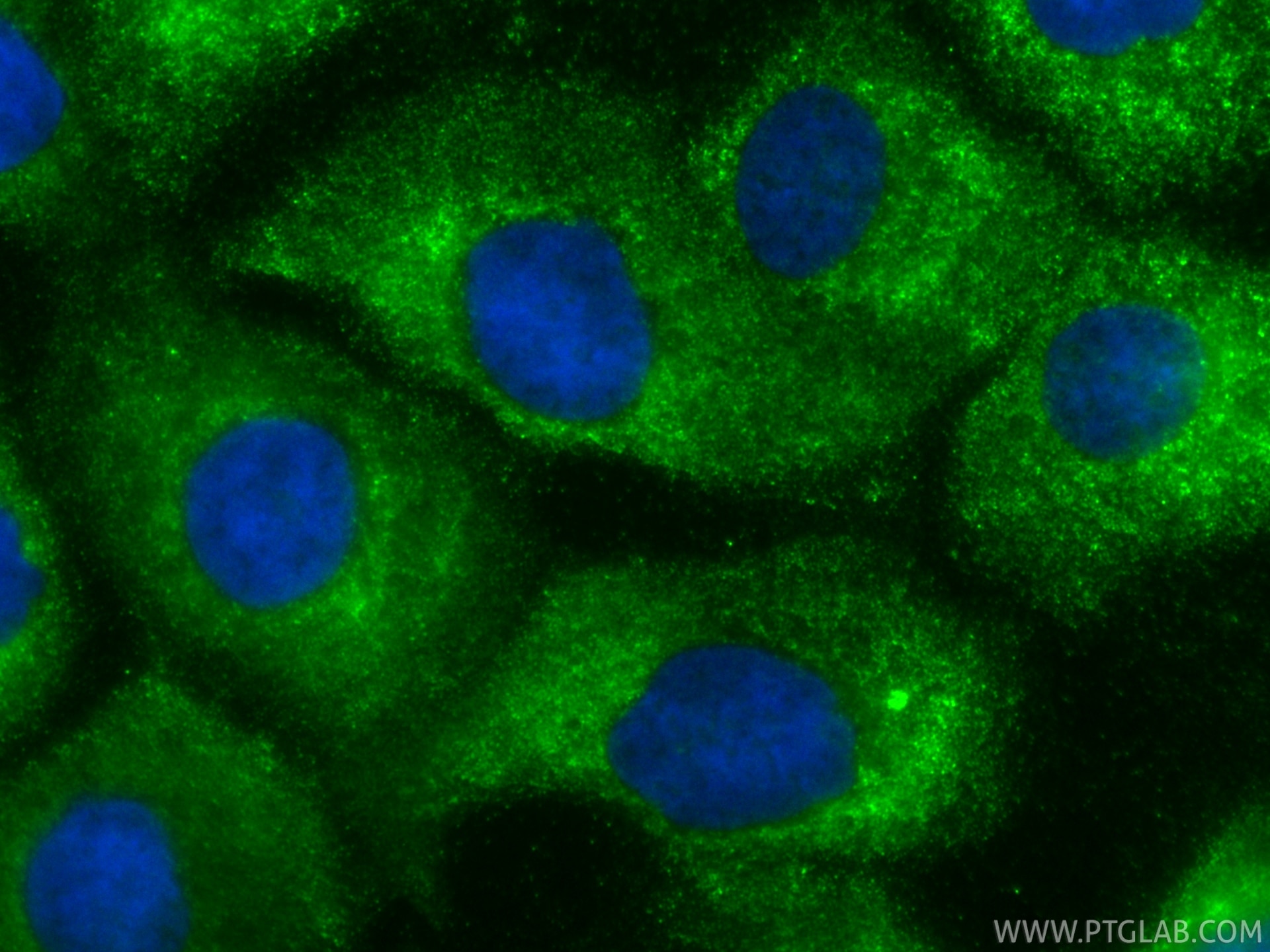 Immunofluorescence (IF) / fluorescent staining of DU 145 cells using CoraLite® Plus 488-conjugated HPSE Monoclonal anti (CL488-66226)