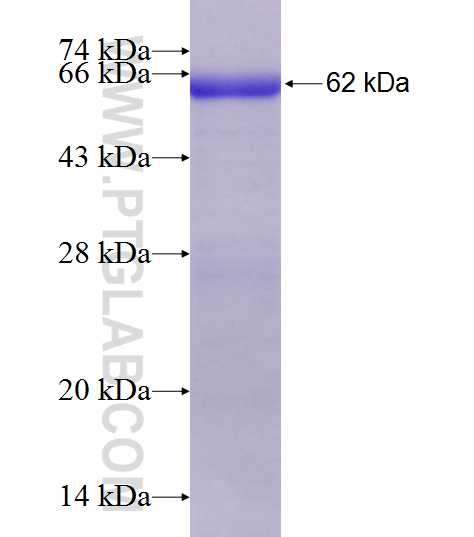 HPSE fusion protein Ag21479 SDS-PAGE