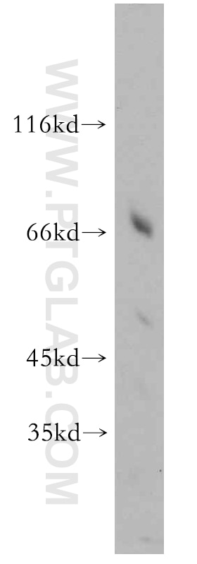 Western Blot (WB) analysis of L02 cells using HPSE2 Polyclonal antibody (21128-1-AP)