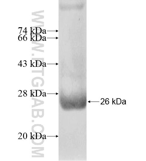 HPSE2 fusion protein Ag15179 SDS-PAGE