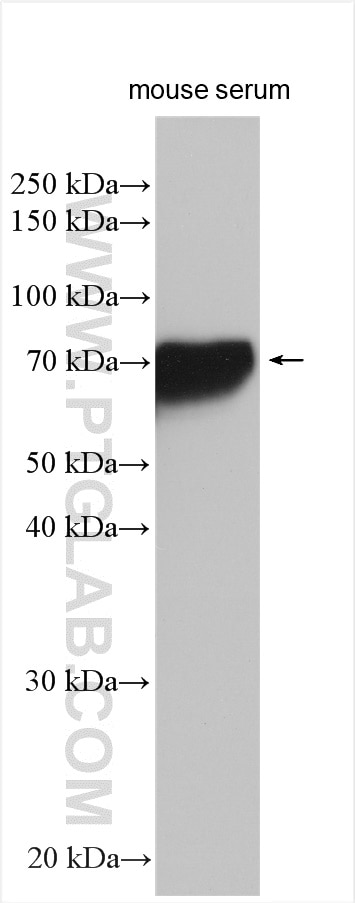 Western Blot (WB) analysis of mouse serum using Hemopexin Polyclonal antibody (15736-1-AP)