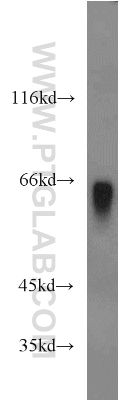 Western Blot (WB) analysis of human plasma using Hemopexin Polyclonal antibody (15736-1-AP)