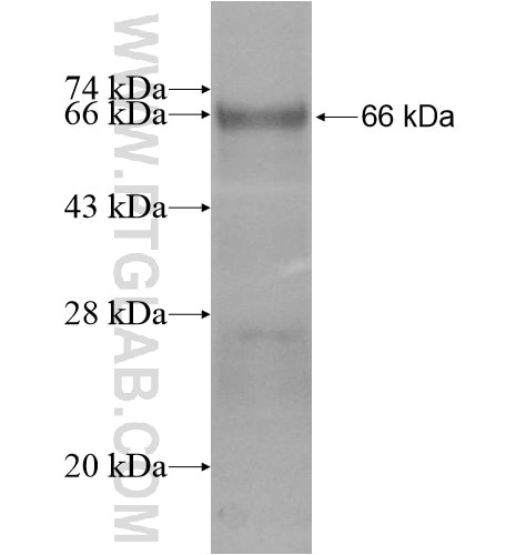 HR fusion protein Ag14181 SDS-PAGE