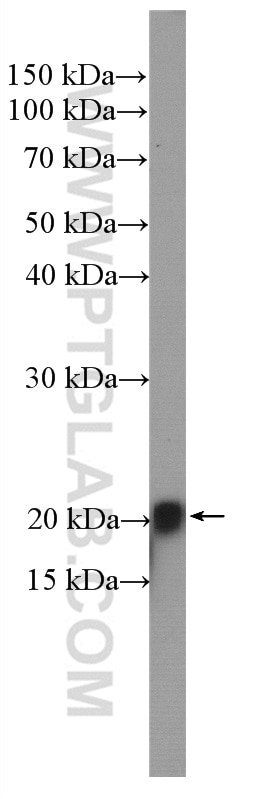 Western Blot (WB) analysis of HeLa cells using HRAS Polyclonal antibody (15531-1-AP)