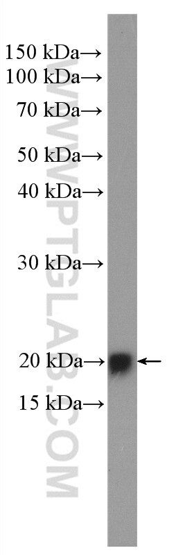 Western Blot (WB) analysis of MCF-7 cells using HRAS Polyclonal antibody (15531-1-AP)