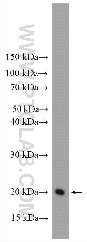 Western Blot (WB) analysis of PC-12 cells using HRAS Polyclonal antibody (15531-1-AP)