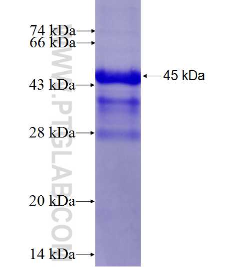 HRAS fusion protein Ag7704 SDS-PAGE