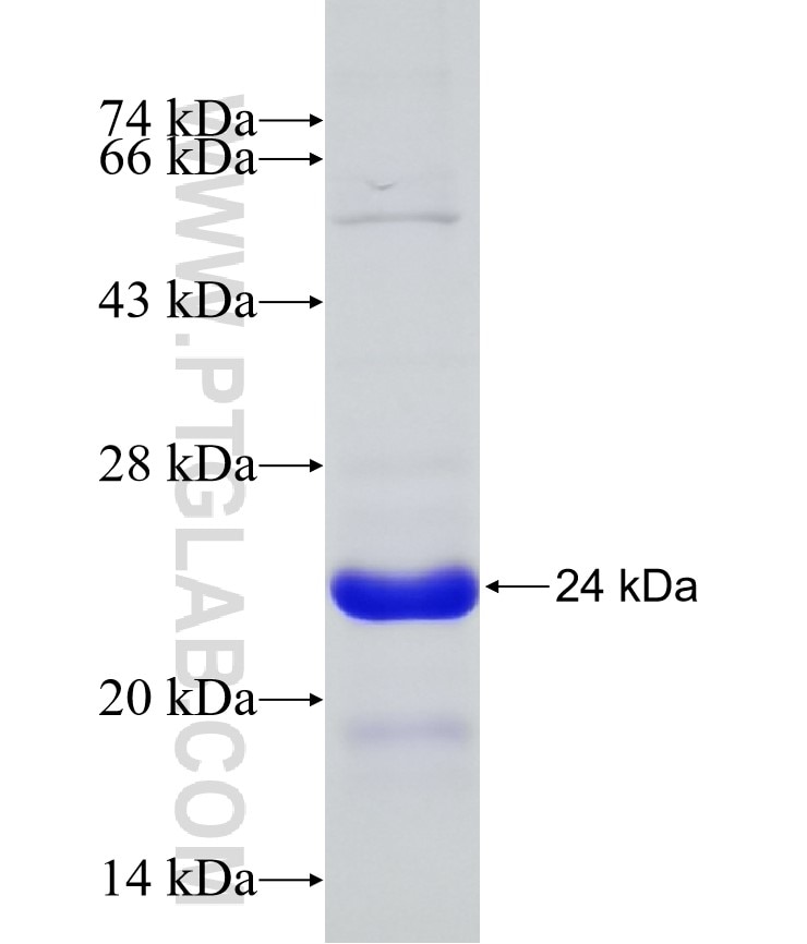 HRAS fusion protein Ag7947 SDS-PAGE