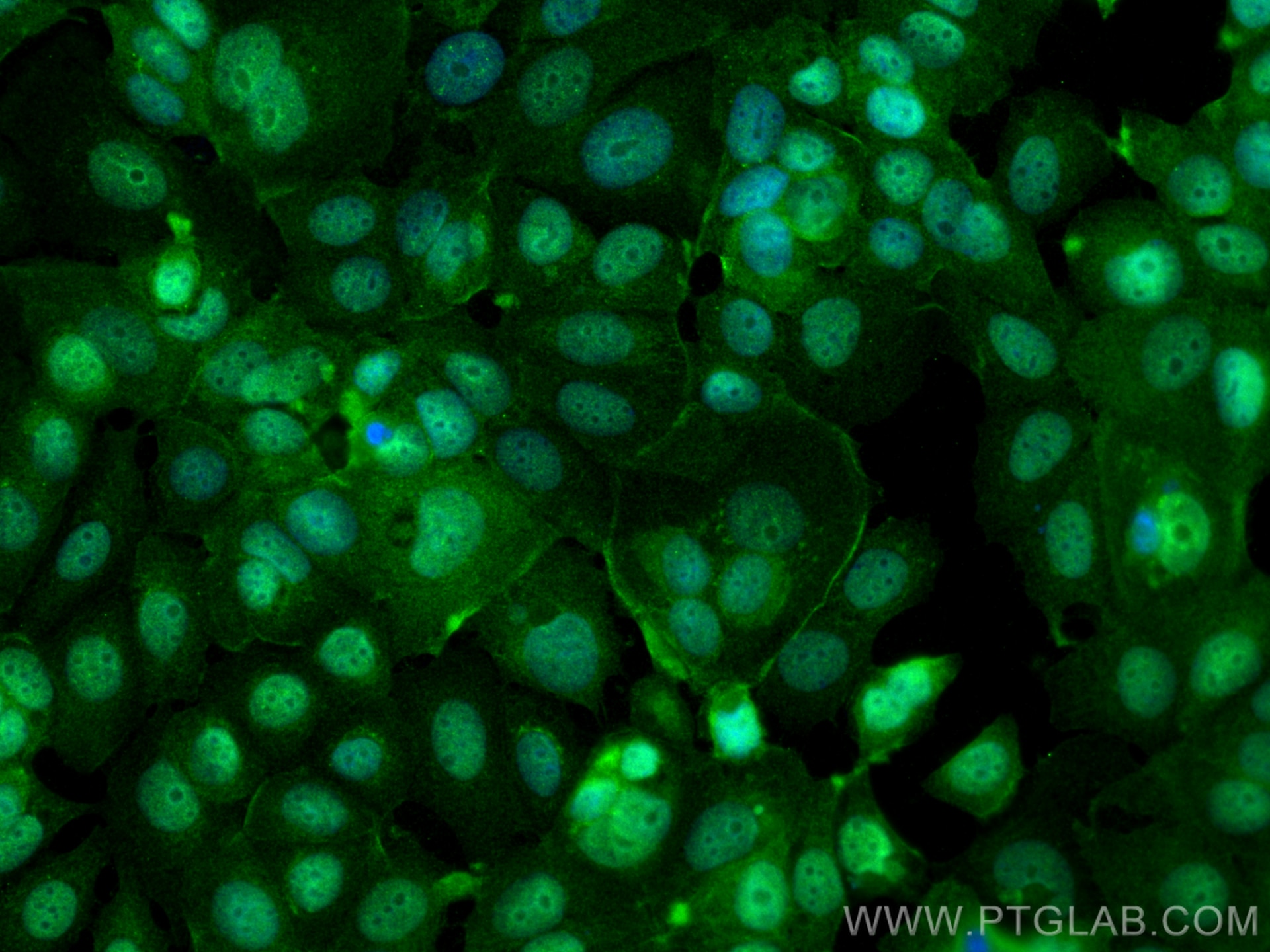 Immunofluorescence (IF) / fluorescent staining of MCF-7 cells using HRAS-Specific Polyclonal antibody (18295-1-AP)