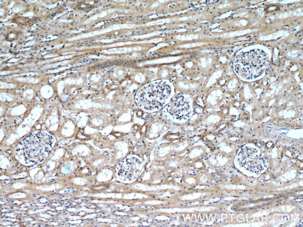 Immunohistochemistry (IHC) staining of human kidney tissue using HRAS-Specific Polyclonal antibody (18295-1-AP)