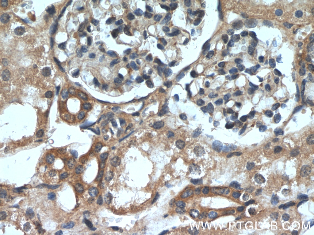 HRAS-Specific Polyclonal antibody