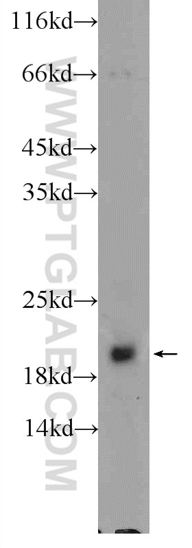 HRAS-Specific Polyclonal antibody
