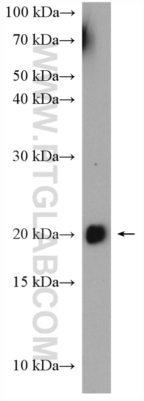 Western Blot (WB) analysis of SH-SY5Y cells using HRAS-Specific Polyclonal antibody (18295-1-AP)